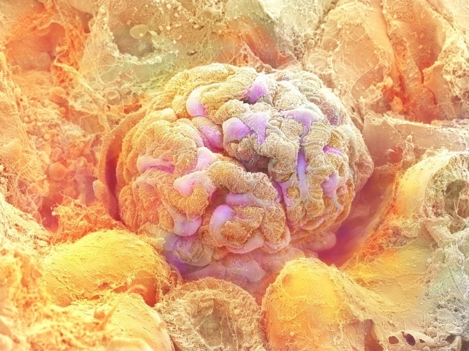 腎臓の糸球体
©甲賀大輔・旭川医科大学/日立ハイテクノロジーズ/NHK